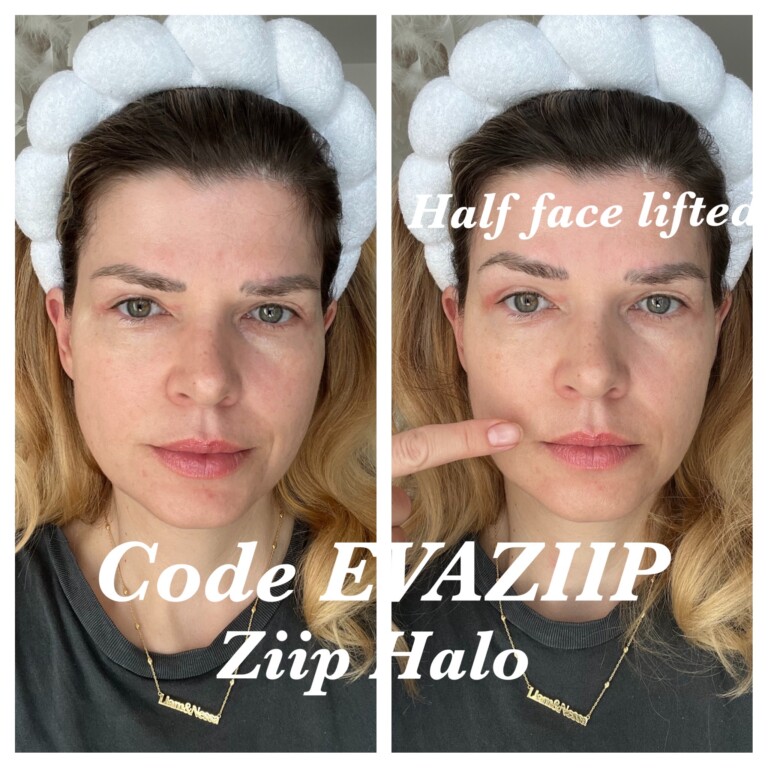 ZIIP HALO REVIEW/ZIIP HALO DISCOUNT CODE